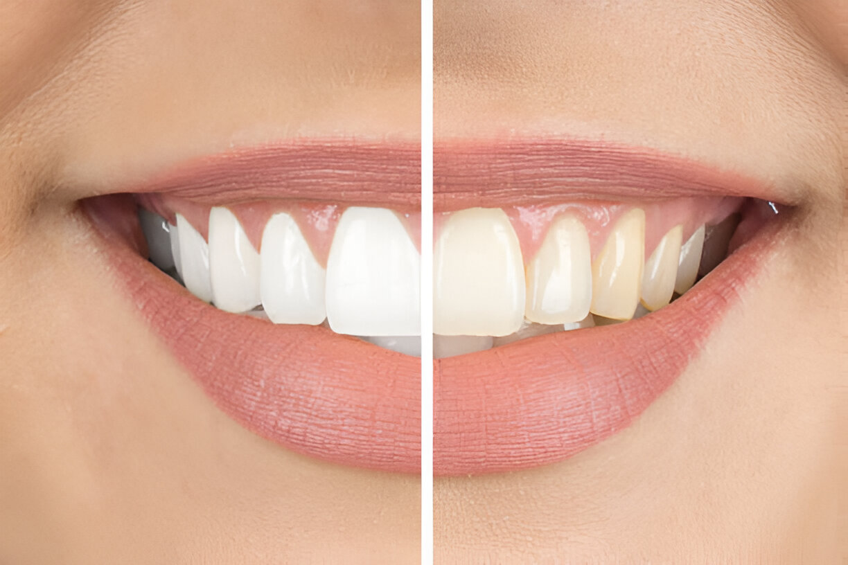 Cosmetic dental clinic near me Guntur