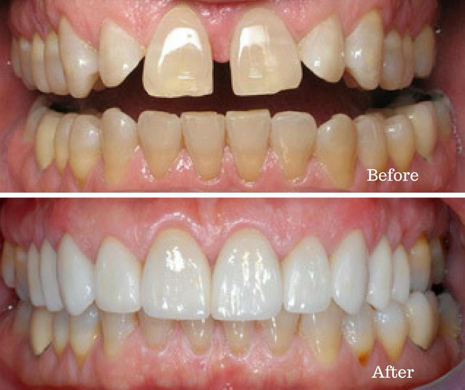 Guntur smile designing dental clinic near me