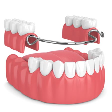 Partial and complete dentures treatment guntur near me