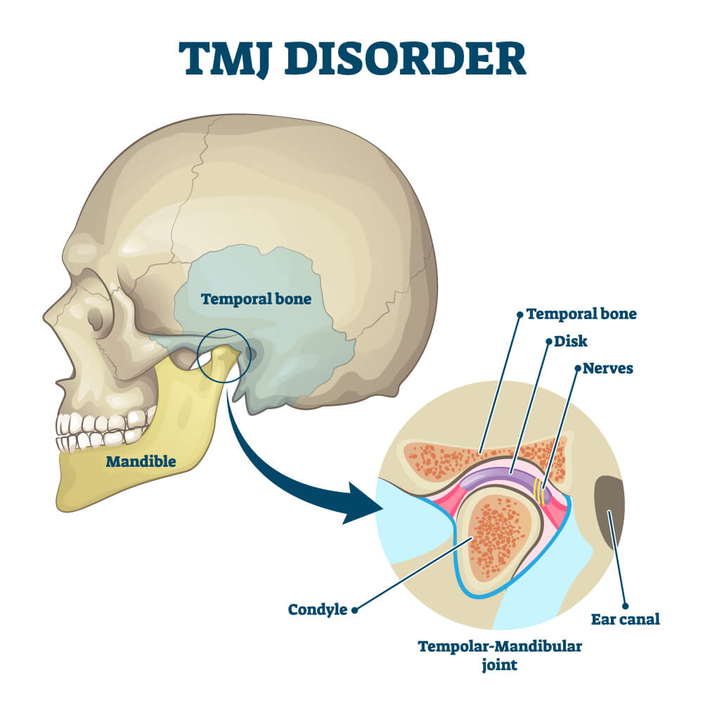 temporomandibular joint dysfunction treatment in Guntur