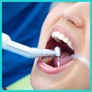dental bridges specialist doctor in guntur