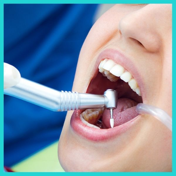 teeth cleaning cost near me