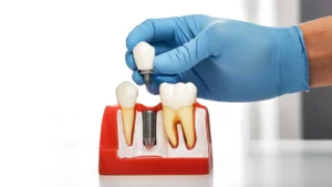 Best Implantologist Doctors in Guntur
