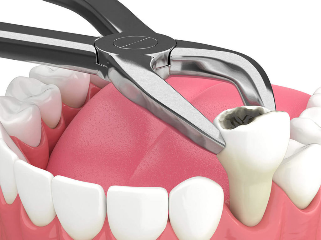 best teeth specialist doctor in guntur