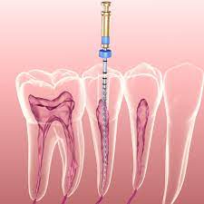 best dental hospital for rtc treatment