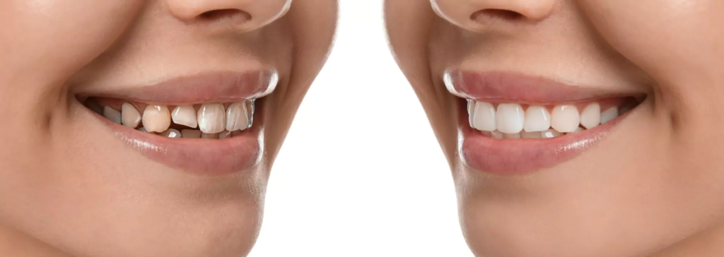 Guntur smile designing aesthetic dental clinic