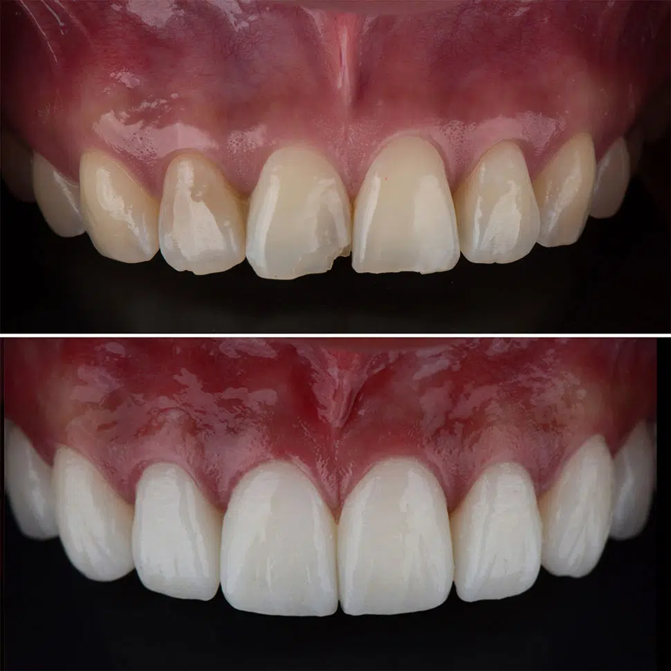 Guntur smile designing center