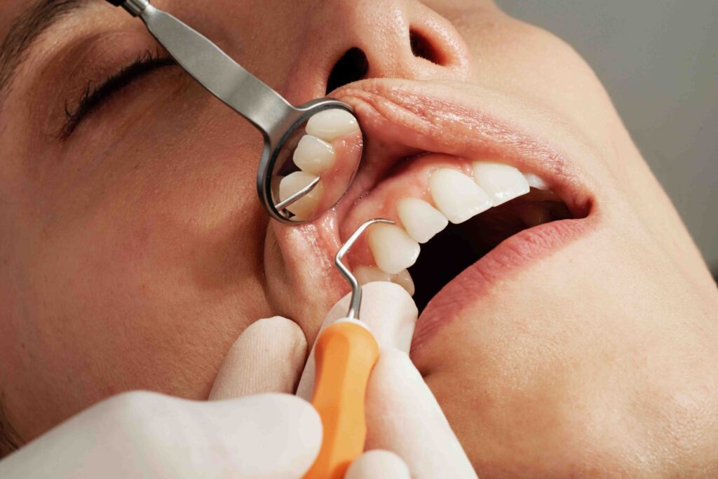 Top and best dental care in guntur