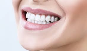 Smile Designing process