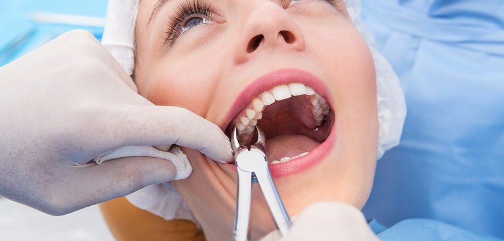 Best dental clinic for tooth extraction in Guntur