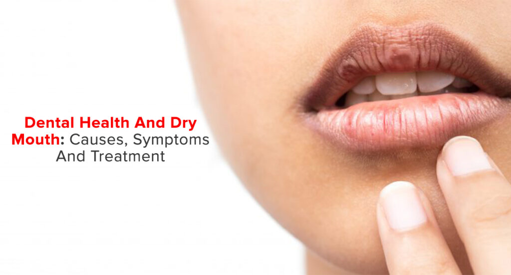 why dry mouth matters?