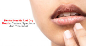 why dry mouth matters?
